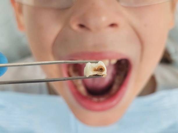 Best Broken Tooth Emergency  in Florence, CO